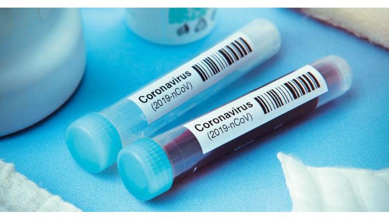 [Translate to Russe:] 